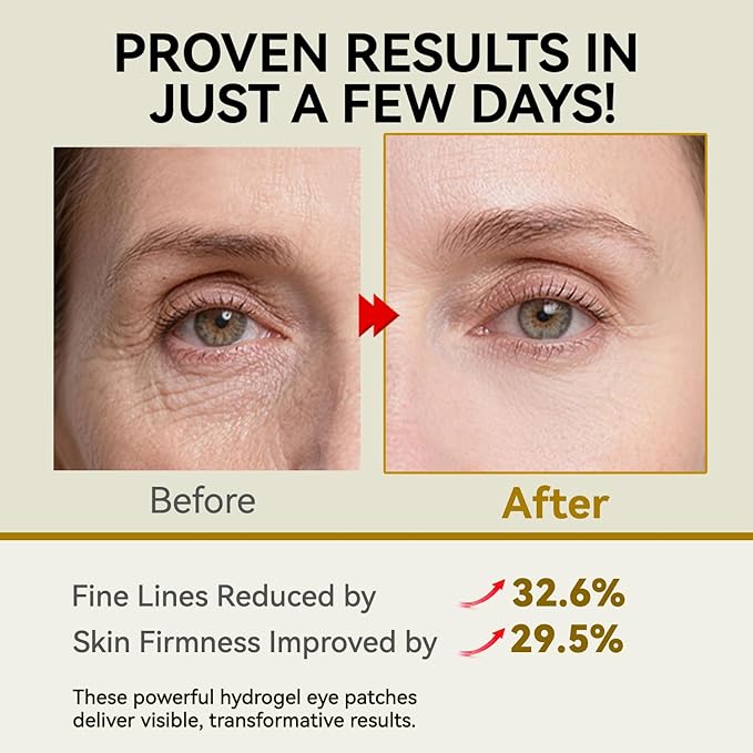 PDRN Under Eye Patches, 25 Pairs Retinol & Caffeine Eye Mask, Collagen Hydrating Eye Pads for Dark Circles, Puffy Eyes & Wrinkles – Eye Treatment Skincare Gift for Men & Women
