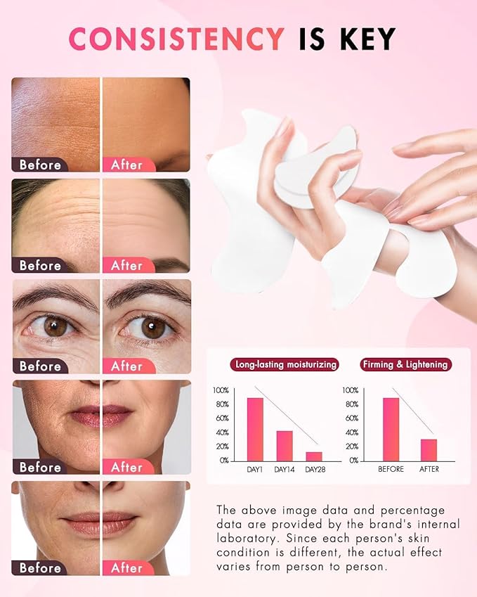 UKVOA Forehead Wrinkle Patches & Smile Line Patches & Under Eye Patches, Overnight Facial Wrinkle Treatment with Hyaluronic Acid, Aloe, Collagen & Vitamin E to Lift Smile Lines for Women 60pcs
