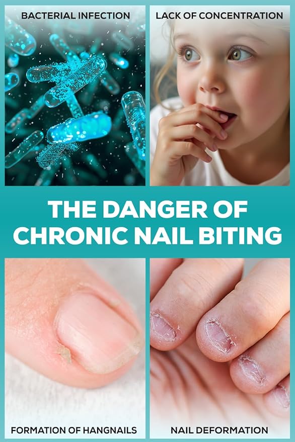 NIXXIT Nail Biting Prevention for Kids - Thumb Sucking Deterrent for Kids, Toddlers, Children - No Bite Nail Polish Pen - Bitter Taste - Safe & Effective Solution for Age 3+