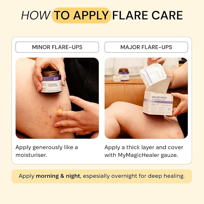 MyMagicHealer Universal Flare Care | Drawing Salve for HS, Boils, Cysts, Hemorrhoids, Pilonidal Cyst, Abscess | Anti-Chafing, Wound Care, Relief for Itching Skin w/Propolis & Egg Yolk Extract 4 oz