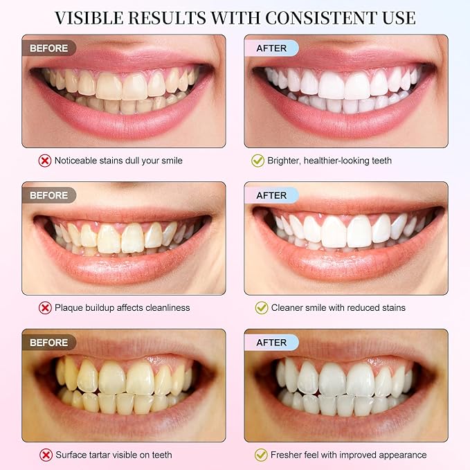 Niacinamide Whitening Toothpaste, 2 Pack Intensive Stain Removal Toothpaste for Yellow Teeth, Gum Care, Fresh Mint & Peach Breath, Tartar Control, Deep Clean for Men and Women, 3.5oz