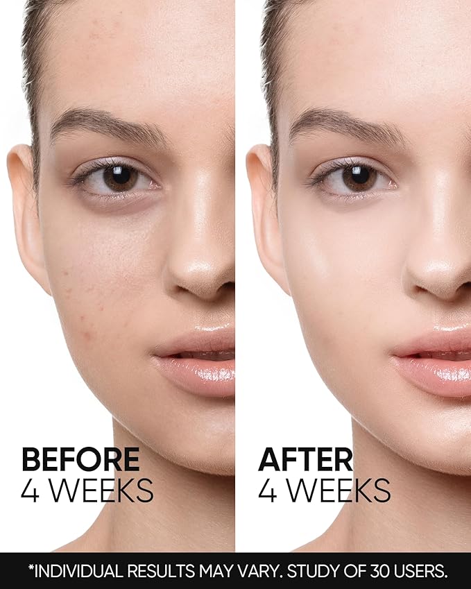 Retinol Skin Renewal Moisturizer, Retinol Cream for Face, Blemish Care, Oil Control & Pore Minimizing, Lightweight, Fragrance-Free, Night Cream for All Skin Types from Age 20+