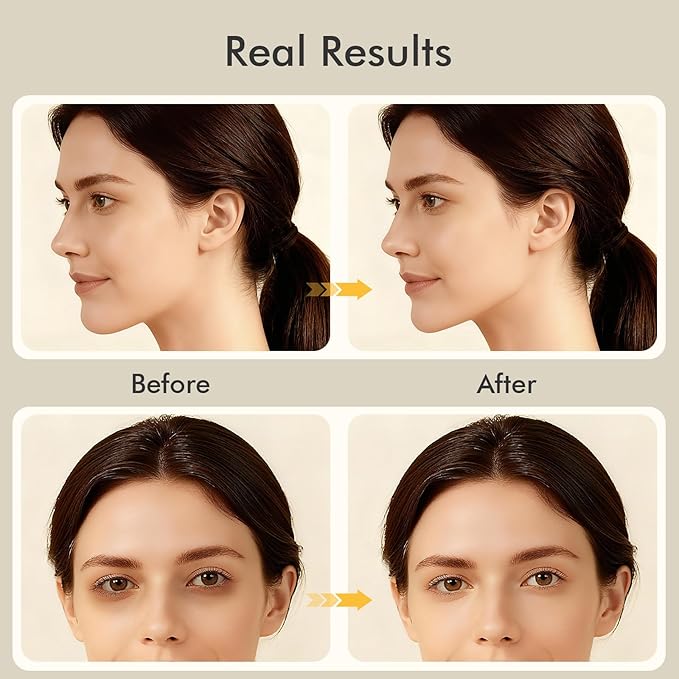 CHOSIN Face Roller Massage Tool, Facial Roller Tool for Lymphatic Drainage - Wrinkles, Lifting & Puffy Eyes for Women Men Self Care Gift (Olive Wood)