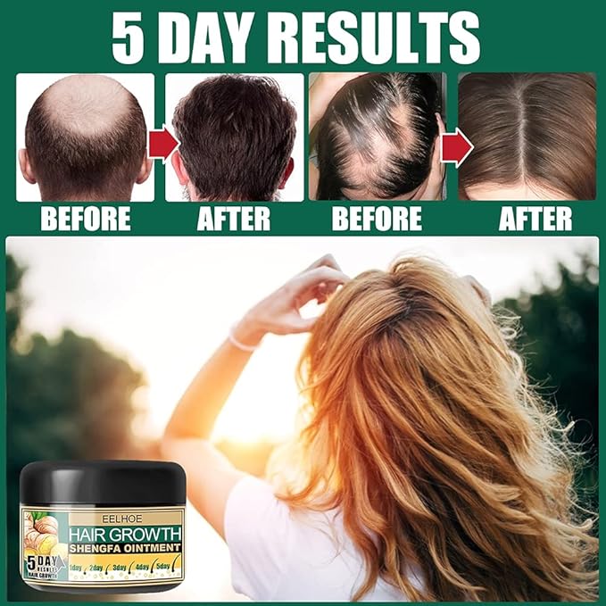 Ginger Hair Growth Cream, Germinal Conditioner, Regrowth Serum - Unisex, For Hair Loss and Thinning(30g/1 OZ sample)