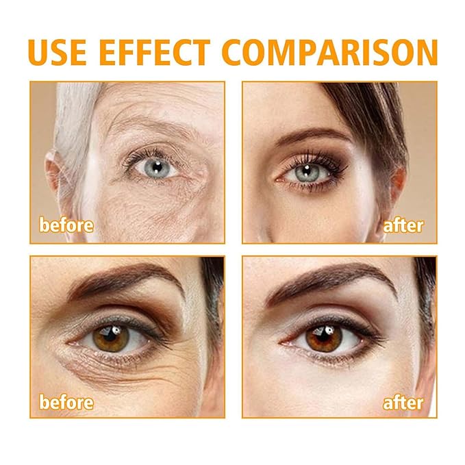 Beauty Crema De Ojos Con Péptidos 5D, Crema De Ojos Con Peptido 5D, Peptide Eye Cream, Eye Cream Anti Aging, For Dark Circles And Puffiness, Skin Under Eyes Moisturize (1PC)