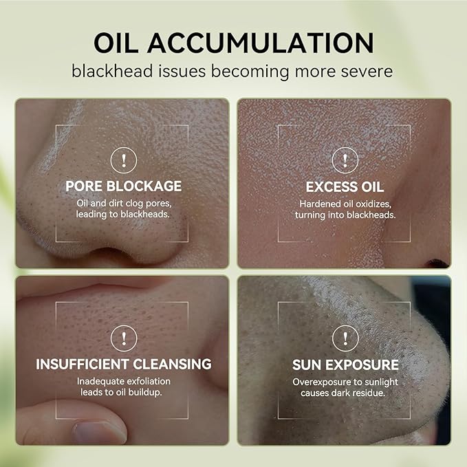 LANBENA Blackhead Remover Nose Pore Strips for Face, 2.0 Upgraded Deep Cleansing Peel off Mask Nose Strips Skincare for All Skin (1.06 Oz/30g) - 60pcs Strips (Bamboo Charcoal Pore Strips+Pore Serum)