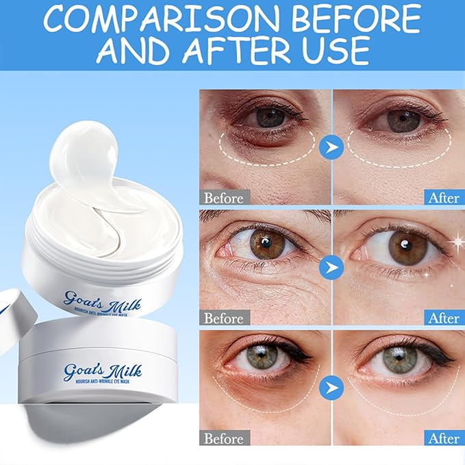 Under Eye Patches for Dark Circles & Puffy Eyes - 60 Pairs Hydrating Eye Mask with Hyaluronic Acid,Hydrolyzed Elastin&Goats Milk - Vegan, Cruelty-Free