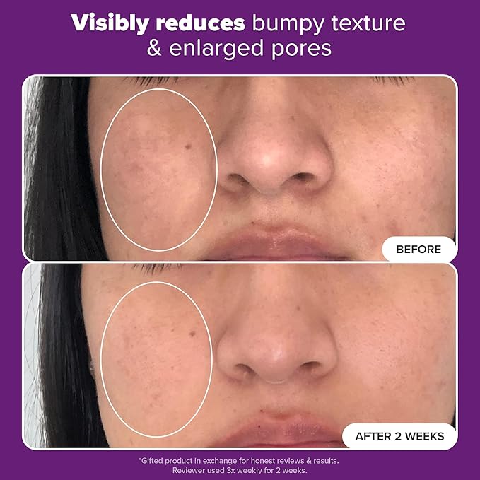 Paula's Choice CLINICAL 20% Niacinamide Vitamin B3 Concentrated Face Serum, Anti-Aging Serum for Face, Treatment for Discoloration & Minimizing Large Pores, Fragrance-Free, 0.67oz