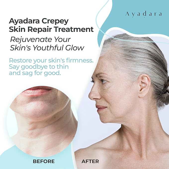 Crepey Skin Repair Treatment 8oz, Firming Lotion for Loose Skin, Crepe Corrector Collagen Cream for Body Tightening, Wrinkle Cream for Face, Neck, Arms and Legs, 500+ Uses