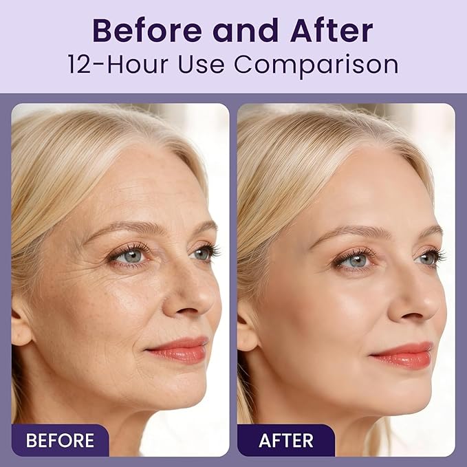 Instant Eye & Face Lift Cream - Rapid Under Eye Bags & Wrinkles Treatment, Dark Circles and Puffiness Remover for Women & Men, Temporary Firming & Tightening Face Cream - Wrinkle Filler 1oz