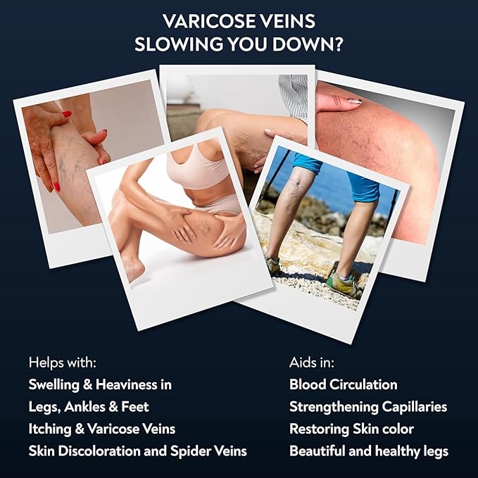 Varicose & Spider Vein Cream for Men & Women | Ayurvedic Ashwagandha Formula for Circulation, Swelling & Tired Restless Legs | Natural, Non-Sticky for Healthy-Looking, Energized Legs!