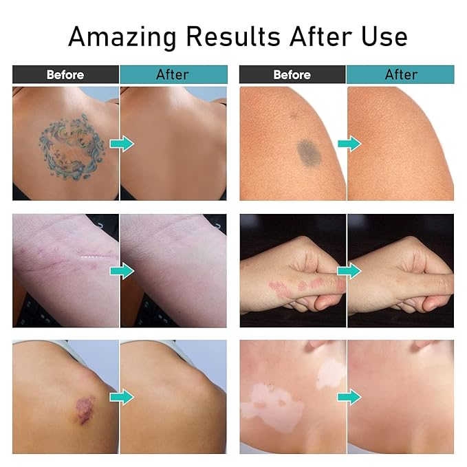 Tattoo Cover Up Makeup Waterproof,Makeup Cover Up,Leg,Body,Waterproof No transfer,Coverage Perfector,Concealer (03 Brown)