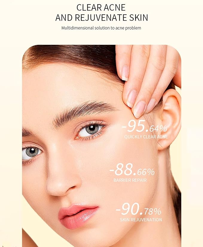 Propolis and Niacinamide Hydrating Facial Soothing Moisturizer, Glow Boosting Serum for Face for Acne-prone&Sensitive skin, Minimize breakouts, Korean skincare 30ml, 1 fl.oz