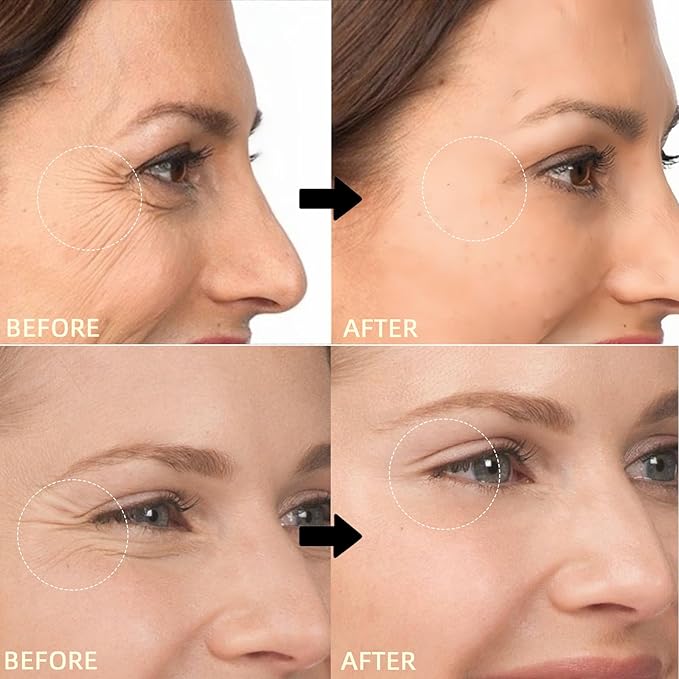 Renewing Retinol & Revive Eye Cream - Helps Improve Look of Fine Lines, Firms & Hydrates for Face and Neck, Refines Skin Texture, Enhances Radiance - 1.35 oz