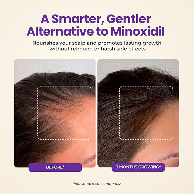 Hair Growth & Thickening Serum With Biotin & Rosemary + Multi-Benefit Treatment for Thinning Hair, Breakage & Split Ends, Boosts Density, Repairs Damage, Hydrates Dry Scalp - For Men and Women, 3 Pack