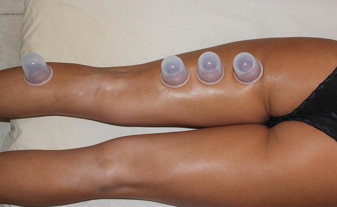Silicone Cupping Therapy Set - Massage Therapy Cups for Arthritis, Pain Relief, Anti Aging, and Anti-Cellulite - Cupping Kit for Relaxation and Muscle Recovery