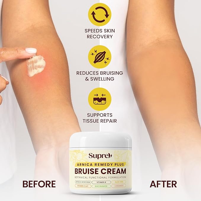 SupreH Arnica Bruise Cream Extra Strength: Vitamin K C & E for Bruising, Swelling and Niacinamide Ceramide for Discoloration & Thin Skin