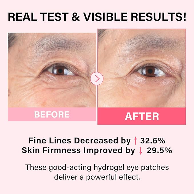 iMethod PDRN Collagen Boost Eye Patches - Under Eye Mask, Instant Lift Eye Mask for Reduce Fine Lines & Wrinkles, Firming Under Eye Patches for Dark Circles, Puffy Eyes, Eye Bags, 2 Pack, 16 Pairs