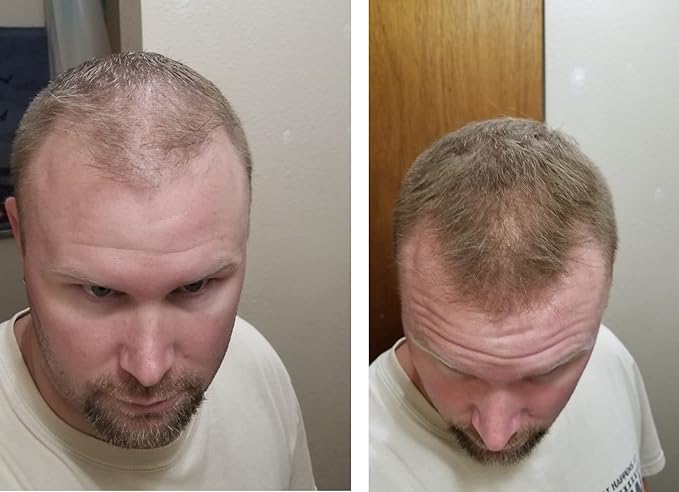Caboki Hair Loss Concealer. Makes Thin Hair Look 10X Fuller Instantly. Eliminates Bald Spot and Thinning Hair (30G, 90-Day Supply). Light Brown