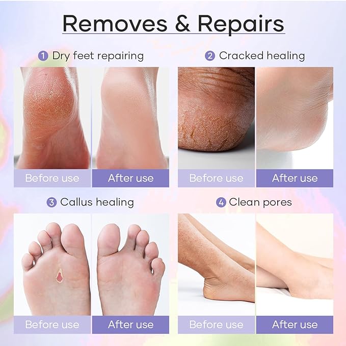 Epsom Salt Soak, Callus Remover Gel, Extreme Sugar Scrub, Collagen Mask & Shea Butter Lotion – Professional Spa Foot Care System 5 Step Luxury Pedicure Kit. Milk & Honey 40 Set