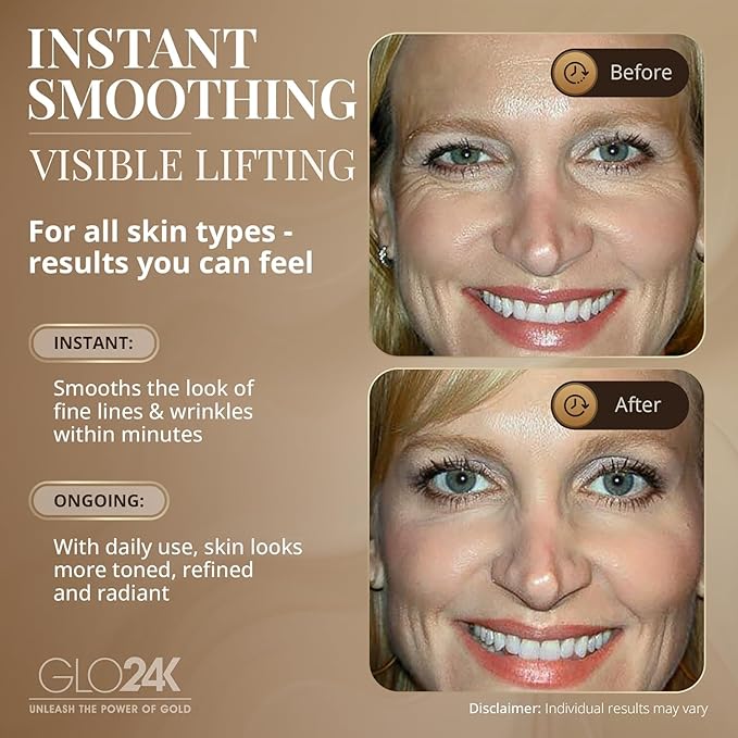 GLO24K Instant Wrinkle Filler for Face, XL Lifting Cream for Eye and Face, Lift and Tightening Non-Invasive with Hyaluronic Acid, 24k Gold, Peptides and Vitamins for Youthful Appearance, 1.2 fl oz (2)