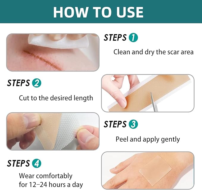 Silicone Scar Tape for Surgical Scars: Medical Grade Scar Gel Sheets for C-Section Tummy Tuck Recovery and Treatment – Reusable Scar Strips for Keloid Burn Acne Scars Removal (1.6'' x 60''Roll-1.5M)