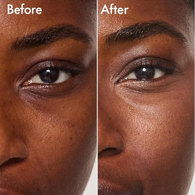 Catrice | Under Eye Brightener | Conceal & Brighten Dark Circles | With Hyaluronic Acid & Shea Butter | Vegan, Cruelty Free & Paraben Free (040 | Dark Mocha)