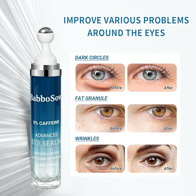 Under Eye Cream for Dark Circles with 5% Caffeine and Retinyl Palmitate, Under Eye Corrector with 360° Roller Massage Ball for Puffy Bags and Fine Lines, 0.76 fl oz