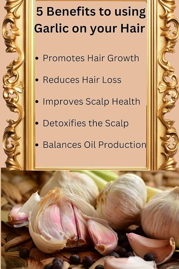 Garlic Conditioner - 32 Fl Oz, Infused with Keratin and Garlic Extract For Damaged Thinning Hair - Stops Hair Loss and Promotes Growth - Deep Conditioning - Sulfate and Paraben Free