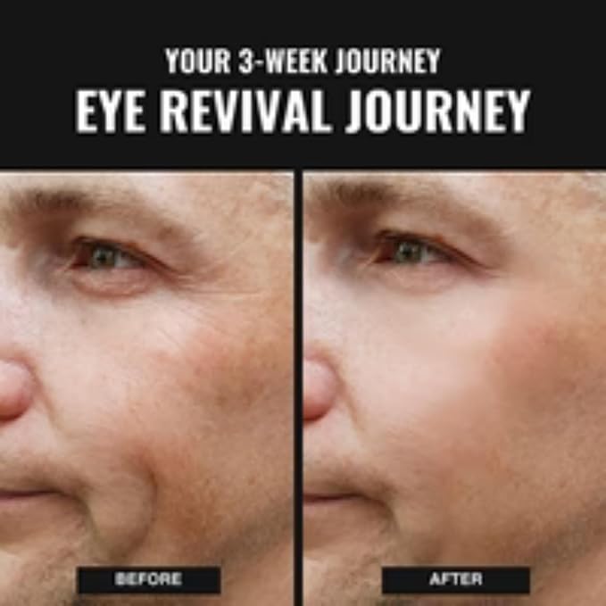 Superior Mane EyeStick Repair for Men | UnderEye Serum Roller for Dark Circles w/Caffeine, Vitamin B3 Peptides & Ceramides | Reduces Puffiness Dark Circles | Anti-Aging Under Eye Stick Dark Circle