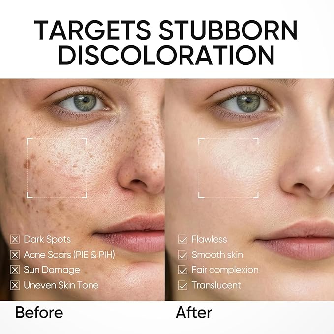 Dark Spot Moisture Cream, Brightening Moisturizer, Fades Dark Spots, Hyperpigmentation, 5X Ceramide Barrier Repair, 24H Hydration, Non-Greasy, 1.76 Fl Oz (Pack of 1)
