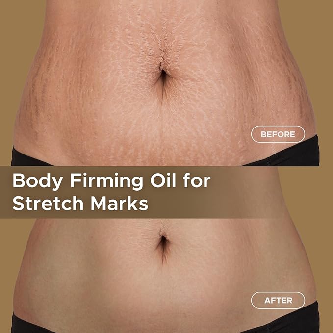 Body Firming Oil: Fast Absorbing Firming & Hydrating Skin Care with Jojoba, Grapeseed & Geranium Oils, Vitamin E | 3.4 Fl Oz Moisturizing Treatment Oil for Tightening After Shower