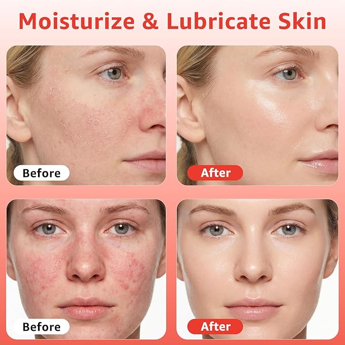 Red Light Therapy Serum, Red Light Therapy Activation Serums Amplify Effects & Reduce Wrinkles with Hydrating, Vitamin E Redlight Serum for Face, Rose Extract Facial Serums for Women, 1.0 FL.OZ