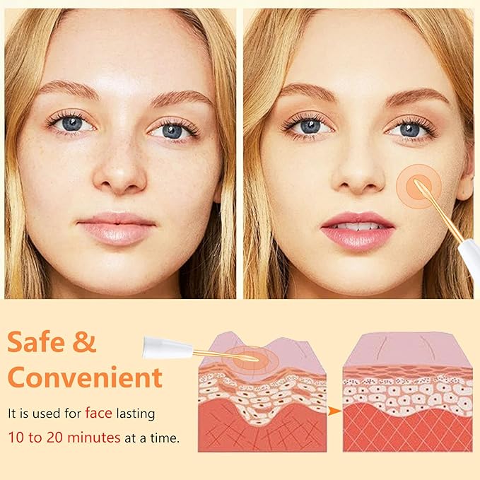 High F Rrequency Facial Wand for Face Care, Multi-Function Face Device Machine