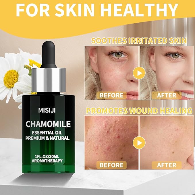 Hand Picking Chamomile Essential Oils-Essential Oils for Diffuser for Home,Diffuser Oils Scents for Aromatherapy,Laundry,Candle&Soap Making,Humidifiers 1 FL.OZ
