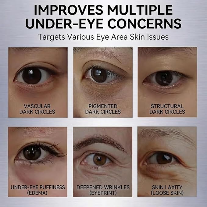 Rovian 8 Pack Reusable Under Eye Patches for Puffy Eyes - Glitter Cooling Gel Eye Pads & Cold Compress Ice Mask for Dark Circles, Swelling & Quick Makeup Prep