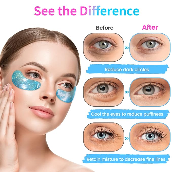 Under Eye Patches (32 Pairs) - Collagen-Infused, Anti-Puffiness & Dark Circle Treatment - Luxurious Skincare for Under Eye Bags & Fine Lines, Gifts for Women