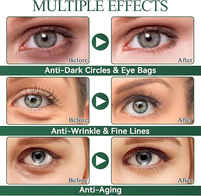Under Eye Patches for Puffy Eyes and Dark Circles – 60 PCS Aloe Vera Under Eye Mask with Pure Natural Extracts to Combat Puffiness, Fine Lines, Wrinkles, and Bags, Parches Para Ojeras Y Bolsas