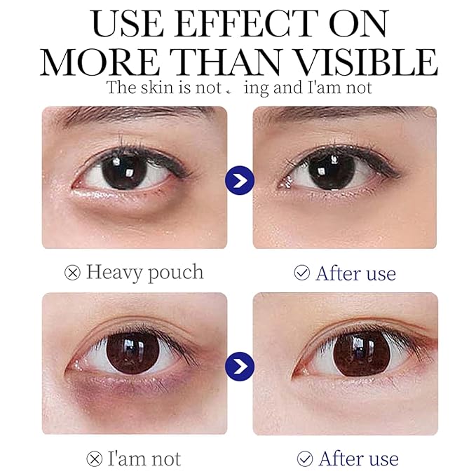 Q.Z.Art Revitalizing Eye Cream Anti Aging with Hyaluronic Acid & Collagen Hydrates Caffeine Reduce Wrinkles, Dark Circles & Under Eye Puffiness, Lift, Firm