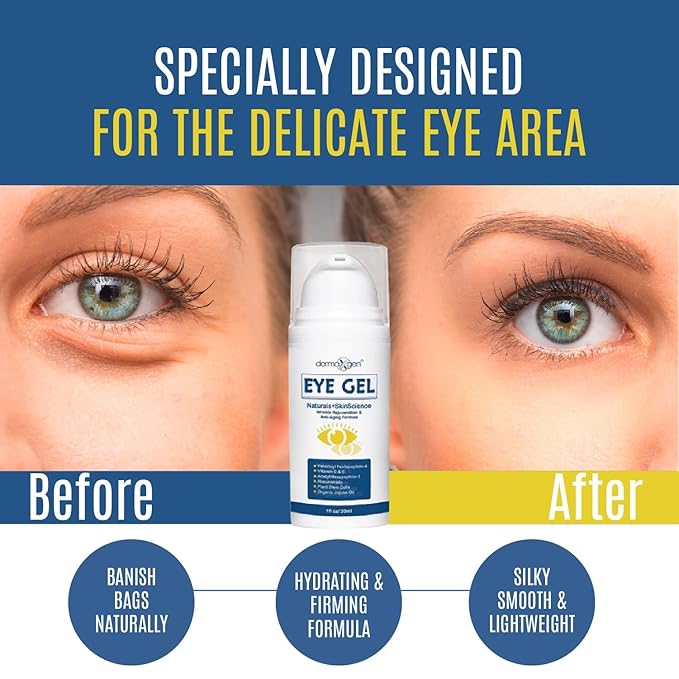 Eye Gel for Dry Eyes – Night Gel with Plant Stem Cells, Matrixyl 3000 & Peptides – Under Eye Gels for Dark Circles and Puffiness | Hydrates for a Smooth, Refreshed Look – 1 Fl Oz / 30 ml