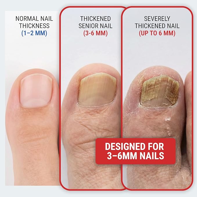 Toenail Clippers for Thick Toenails – KLIPP 15 mm Wide Jaw Thick Fingernail and Toenail Cutter with Curved Stainless-Steel Blades for Seniors (Angled Wide Opening)