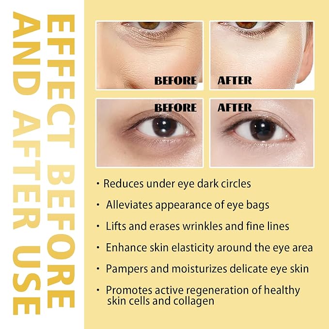 Castor Oil and Frankincense Eye Roller for Dark Circles, Puffy Eyes, and Wrinkles, Anti Aging Eye Serum Cream, 0.34 Fl Oz