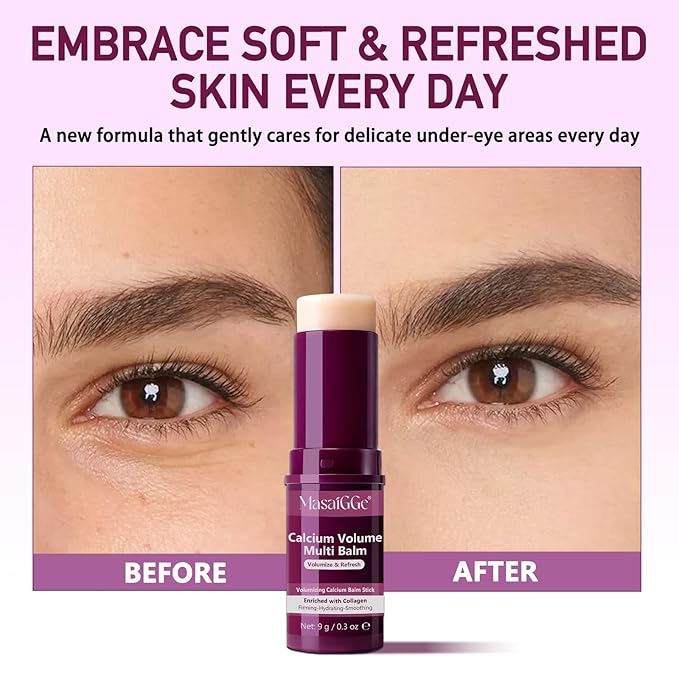 ABOUME Calcium Multi Balm Stick, Calcium Balm for Wrinkles, Anti-aging, Hydrating and Firming Skin, Collagen Stick for Face, Eyes & Neck (1pcs)