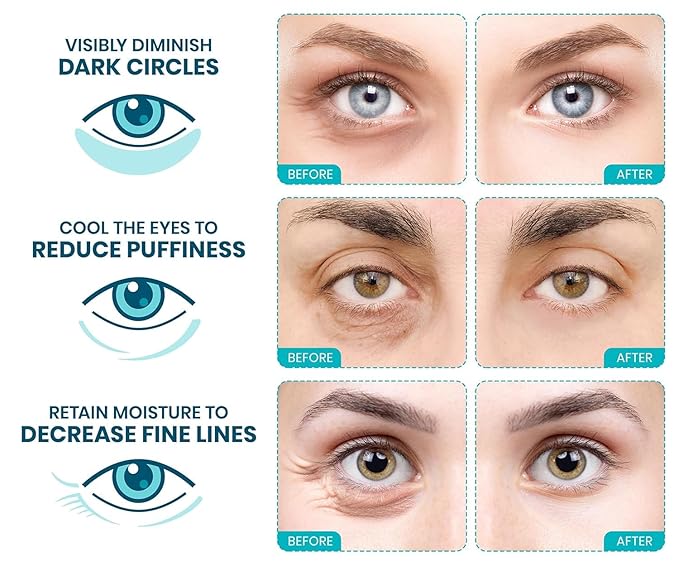 Stylia Collagen & Vitamin C Under Eye Patches for Puffy Eyes & Dark Circles - Depuffing, Hydrating & Firming Under Eye Mask with Hyaluronic Acid - Vegan, Cruelty-Free Skincare (30 Pairs)
