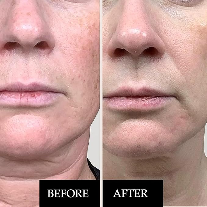 Kleem Skin Rejuvenation Trio - Firming Retinol Face Cream, Brightening Vitamin C Serum & Anti-Aging Eye Cream for Wrinkles, Dark Spots, Uneven Skin & Dark Circles - Complete Skincare Set