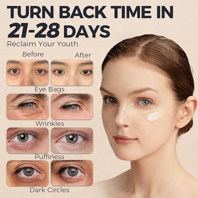 Retinol Under Eye Cream – Anti-Aging Cream for Dark Circles, Puffiness & Wrinkles with Caffeine & Peptide Firming & Hydrating Formula to Reduce Fine Lines 0.7 Fl.Oz