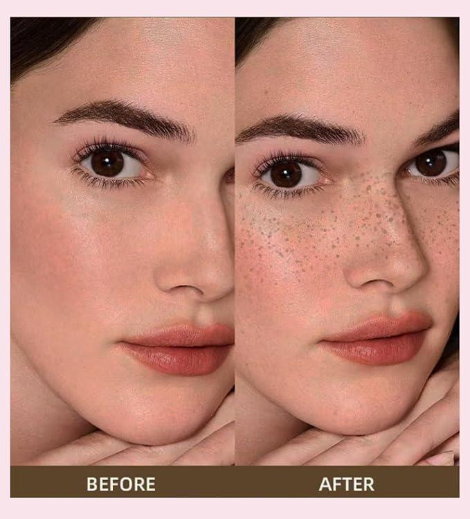 Freckle Stamp with 5 Point Precision Stamp Head, Natural Looking Faux Freckle Stamp Waterproof Fake Freckle Stamp Pen, High Pigment Long-Lasting Lifelike Sunkissed Pencil Tool Makeup (04# Espresso)