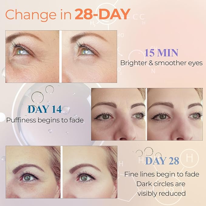 Look At Me Vitamin C Bright Eyes Hydrogel Eye Patches – Dark Circles & Puffiness Relief, Citrus Firming Eye Masks for Men & Women, 5 Pairs – Made in Korea