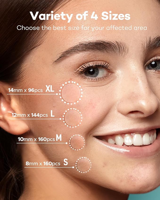 TKTK Pimple Patch Acne Patch, 4 Sizes 560 Patches Acne Absorbing Cover Patch, Hydrocolloid Invisible Acne Patches For Face Zit Patch Acne Dots Tea Tree, Calendula Oil - 4 Pack