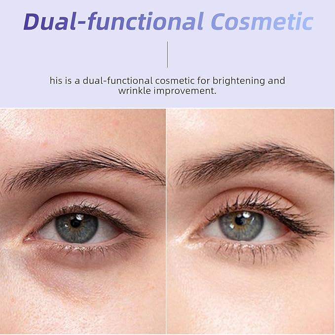 MEDB Retinol Eye Cream for Dark Circles & Wrinkles, Eye Cream Anti-Aging Under Eye Treatment with 7 Peptides & 3 Hyaluronic Acid for Hydration and Elasticity, Includes 360°Massage Roller, 30ml